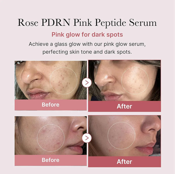 PDRN-PINK-PEPTLDE-SERUM-Pink-Peptide-Collagen-Facial-Hydrating-Moisturizing.jpg